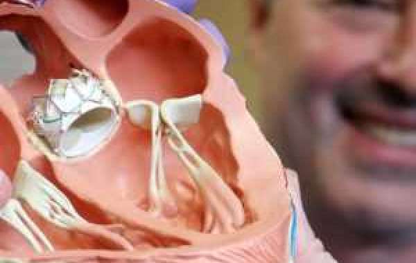 Heart valve replacement surgery India