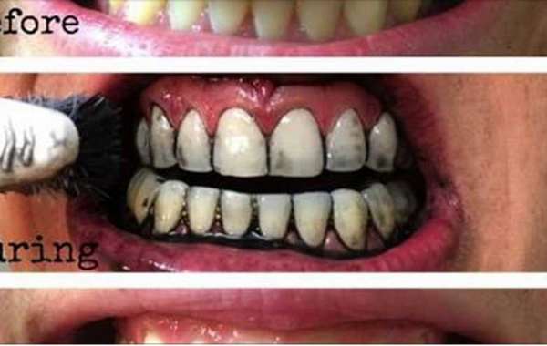 .zip Make My Teeth Whiter Fast Home Download License X32