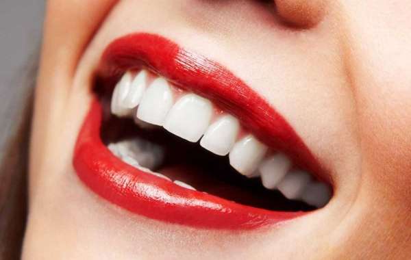 What Do Veneers Cost For Teeth Full Version Nulled 32bit Activation .rar Windows
