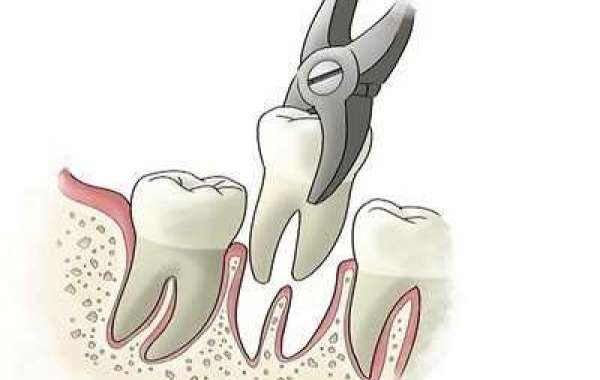 Extraction Of Teeth Meaning Cracked .rar Full 32