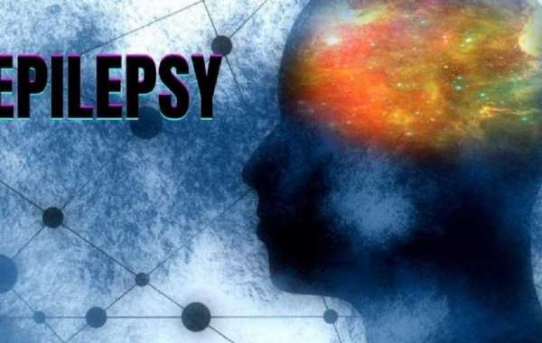 What is Epilepsy Treatment? How to Choose the Best Doctor for Treatment?