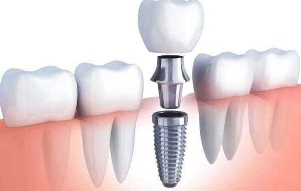 Comprehensive Dentistry for Adults Services in McKinney, TX