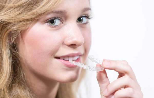 The Science of Invisalign: How Clear Aligners Work