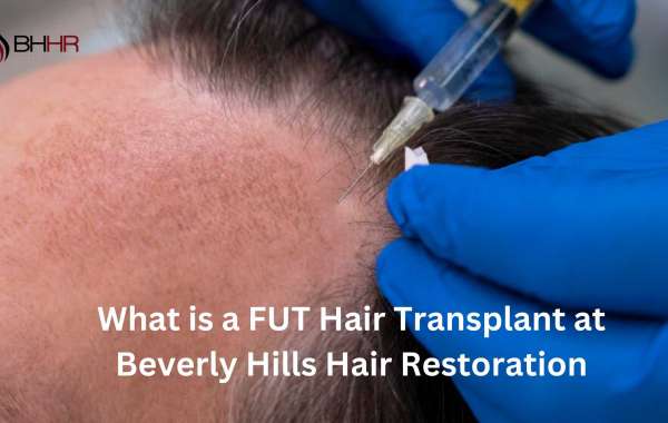 What is a FUT Hair Transplant at Beverly Hills Hair Restoration
