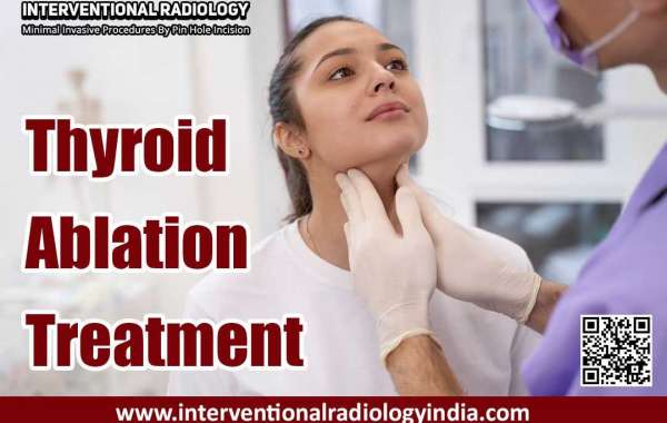 Thyroid Ablation Treatment in India: Leading the Way with Dr. Ajit Yadav