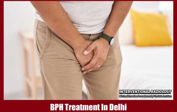 Prostate Embolization Treatment in Delhi: Expert Care with Dr. Ajit Yadav