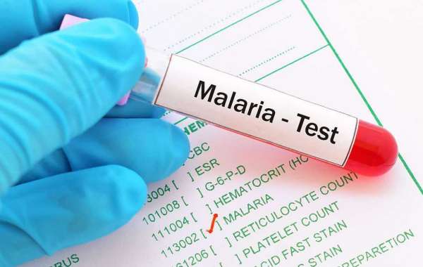 Malaria Diagnostics Market Key Players, Dynamics & Latest Trades Report to 2032